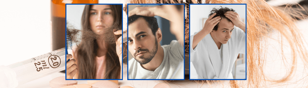 Soluciones naturales para caída de cabello en hombres y mujeres