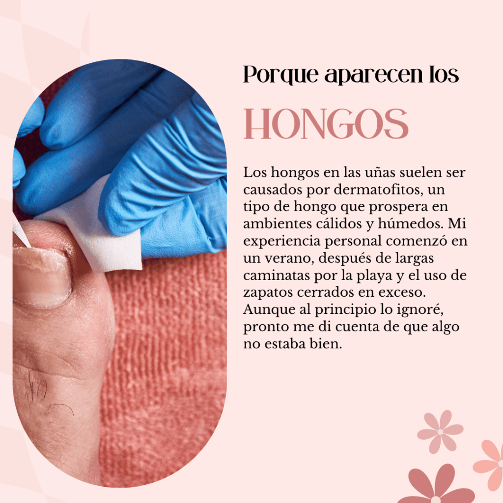 Antes y después de un tratamiento efectivo para hongos en las uñas de los pies. Prevención de hongos en las uñas al usar sandalias en duchas públicas
